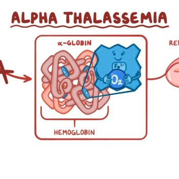 Alpha thalassemia