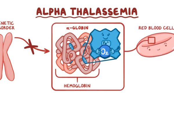 Alpha thalassemia