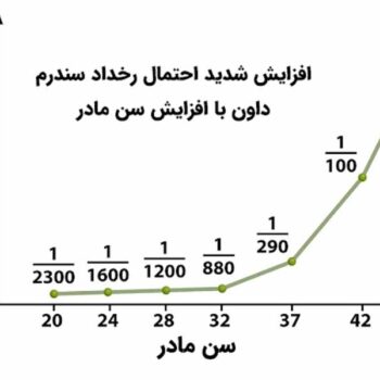 جدول رابطه سن مادر و سندرم داون