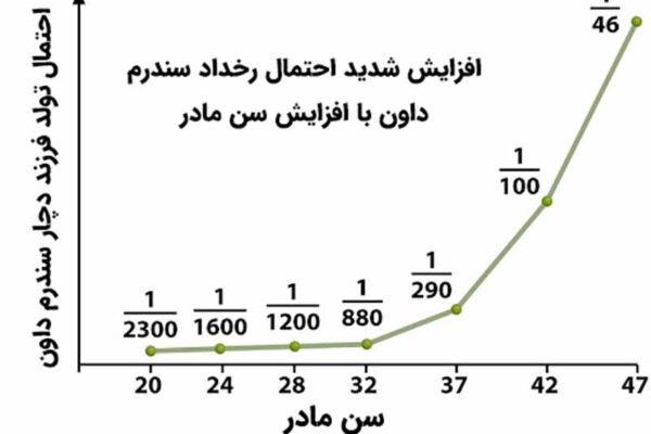 جدول رابطه سن مادر و سندرم داون